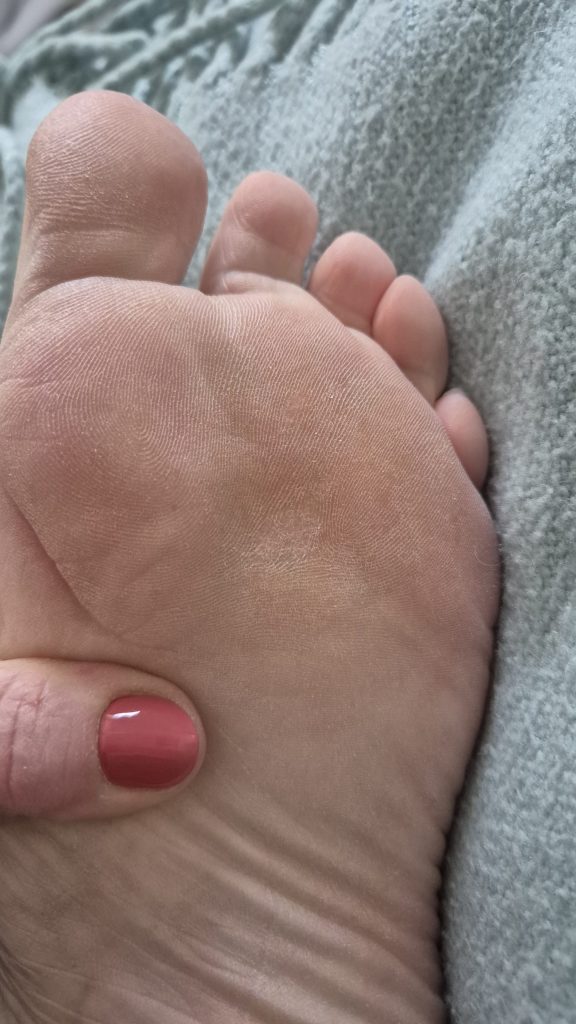 Case 3: the same area after three Swift treatments, resolved
